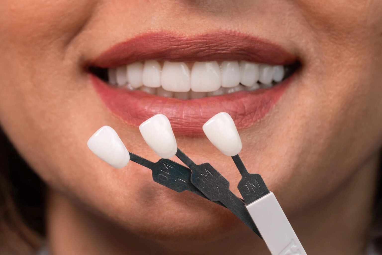 Teeth whitening and smile makeover Jaipur
